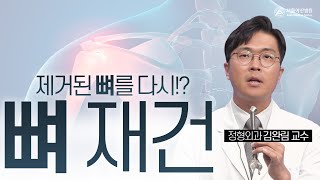 뼈 재건으로 망가진 뼈를 복원하거나 재활용할 수 있다? 미리보기