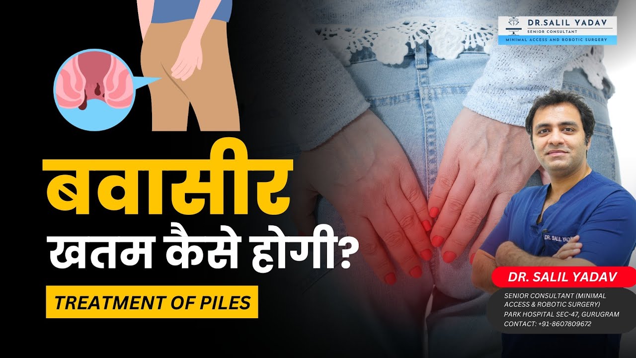 बवासीर खतम कैसे होगी? | How are hemorrhoids (piles) treated? | Dr. Salil Yadav