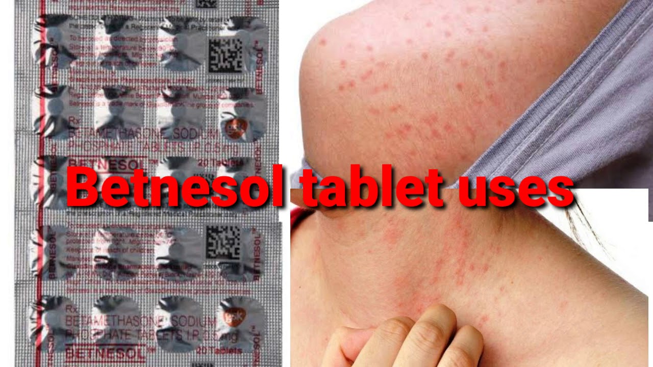 Betnesol tablet uses in telugu best tablet for skin infections