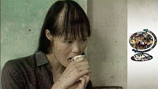 The Horrific Impact Of Agent Orange In Vietnam (2003)