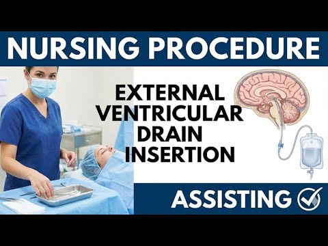 External Ventricular Drain (EVD) Insertion, Assisting