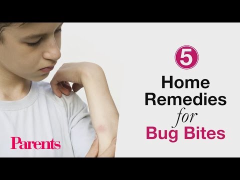 Home Remedies for Bug Bites | Parents
