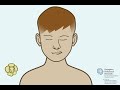 Alveolar bone grafting: for children with a cleft lip and/or palate