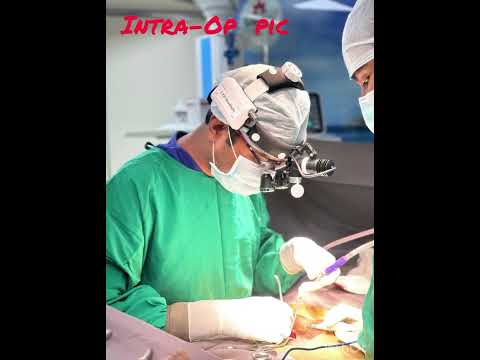 Discectomy | Obese | spine surgery | Dr. Sudheer Pothu