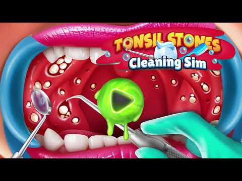 Tonsil Stones Simulator video thumbnail