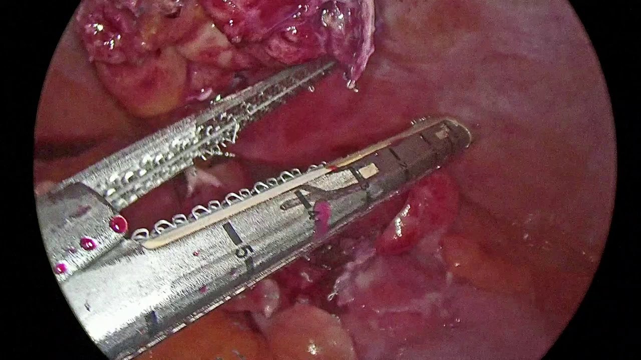 Luis Hernández Miguelena-21