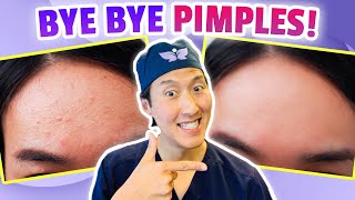 MUST DO’s to Get Rid of Acne HOLISTICALLY! Get CLEAR Skin Tomorrow! - Dr. Anthony Youn