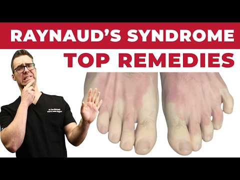 Blood Clot in leg symptoms What causes blood clots WHAT TO DO