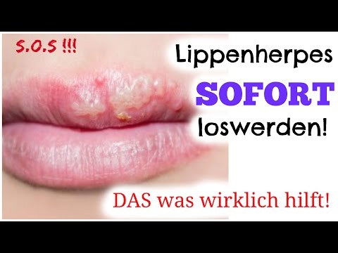 Ist Abstinenz kann Prostatitis Prostata Schmerzen Ei
