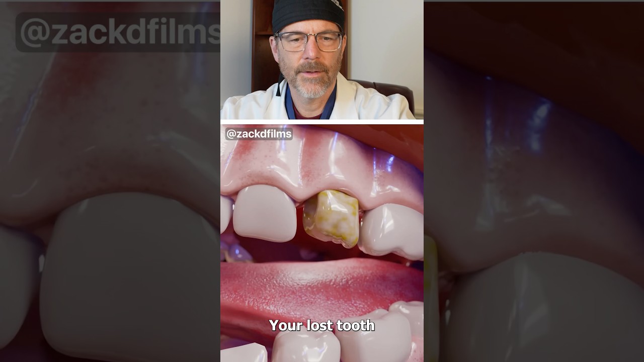Smart Dental Implants 🤔 (explained) Surgeon Reacts