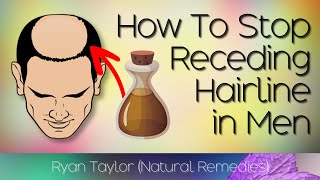 How To Stop A Receding Hairline in Men (Natural Remedies)