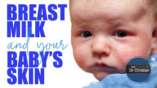 Can BREASTMILK upset your baby