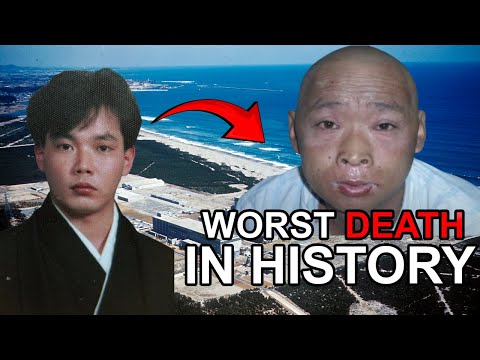 DNA Destroyed in Nanoseconds - Most Radioactive man | Hisashi Ouchi