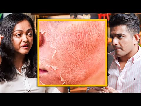 CELEBRITY SKIN CARE Secret - "Skin Peels" Explained By Bollywood's Dermat Dr.Rashmi