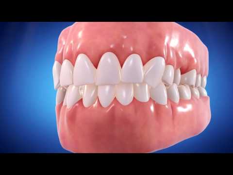 Elite Dental Care video.