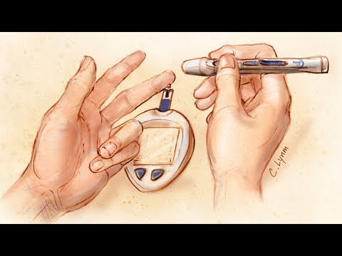 Glucose Self-monitoring in Non–Insulin-Treated Patients With ...