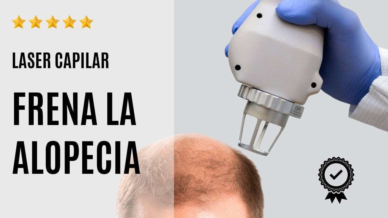 Watch 🔬 Laser Capilar 👉 Para la caída del cabello o ALOPECIA Now 🔬 Laser Capilar 👉 Para la caída del cabello o ALOPECIA