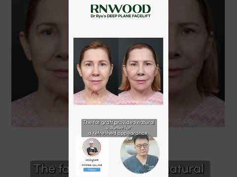 Logo of Remarkable Deep Plane Facelift Procedure in Seoul, South Korea: An In-Depth Case Study