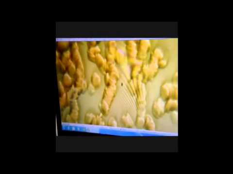 Камена  биорезонансный прибор! Отзыв Покотило Лилии.