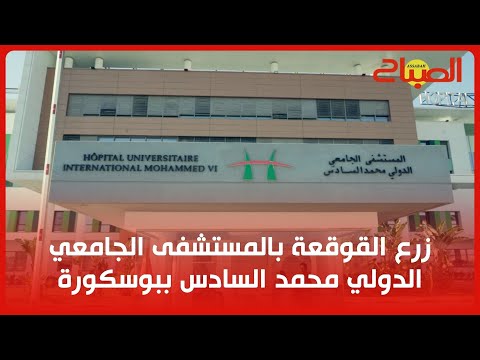 زرع القوقعة بالمستشفى الجامعي الدولي محمد السادس ببوسكورة