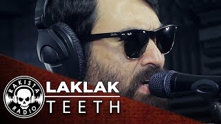 Video thumbnail of "LAKLAK by Teeth | Rakista Live EP148"