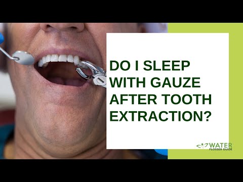 YouTube video about: How long do I keep gauze in mouth after extraction?