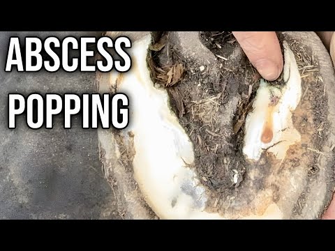 Painful Abscess Gets Popped