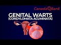 Genital Warts (Condylomata Acuminata)