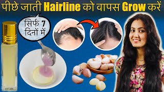 7 Days Challenge : गायब होती HAIRLINE को दोबारा उगाने के आसान तरीके | Grow Receding Hairline 100%❤️