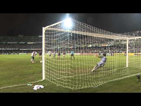 Câmera Coxa - Coritiba 4 x 1 Vitoria