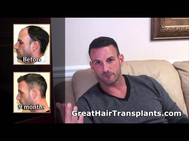 Patient Hair Transplant Video