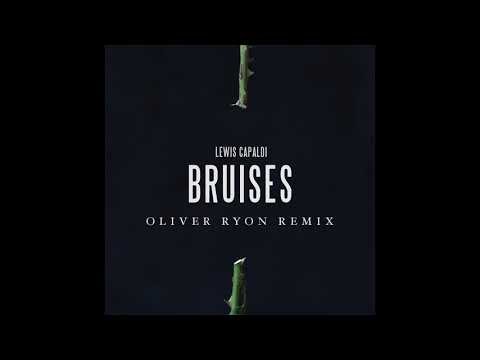 Bruises - Oliver Ryon Remix