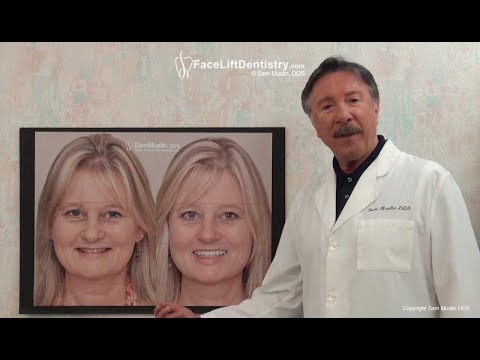 A Face Lift Without Surgery