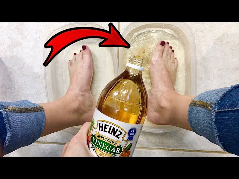 , title : 'PUT APPLE CIDER VINEGAR ON YOUR FEET AND SEE WHAT HAPPENS! 👀😳'
