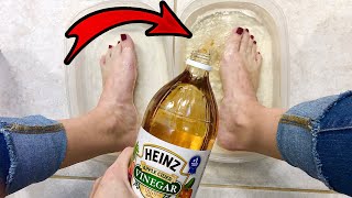 PUT APPLE CIDER VINEGAR ON YOUR FEET AND SEE WHAT HAPPENS! 👀😳