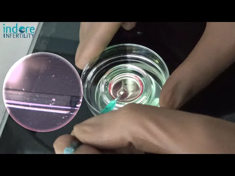 Frozen Embryo Tansfer (FET) - How are Embryos Warmed ( Thaw) in IVF Lab. FET Procedure Step By Step.