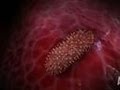 Bubonic Plague Eats Man Alive Monsters Inside Me