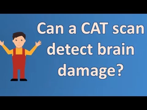 Can a CAT scan detect brain damage ? | Health and Life