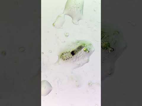 These MITES live on your FACE!