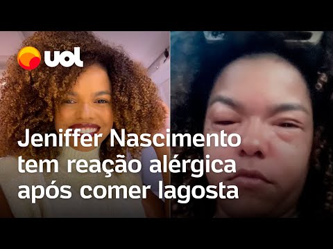 Jeniffer Nascimento tem reação alérgica após comer lagosta: 'Muito severa'