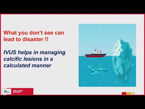 IVUS guided optimization of complex PCI Dr  Prasant Kumar Sahoo