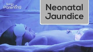 Neonatal Jaundice - Causes, Symptoms and Treatment