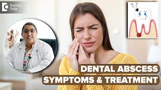 Abscessed Tooth | Pus in Tooth | Dental Infection - Dr. Karthika Krishna Kumar| Doctors