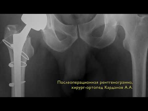Подготовка на мрт грудного отдела позвоночника Сустав пальцы рук косточки