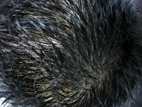 download lagu mp3 mp4 Can You Make Hair Grow Faster, download lagu Can You Make Hair Grow Faster gratis, unduh video klip Can You Make Hair Grow Faster