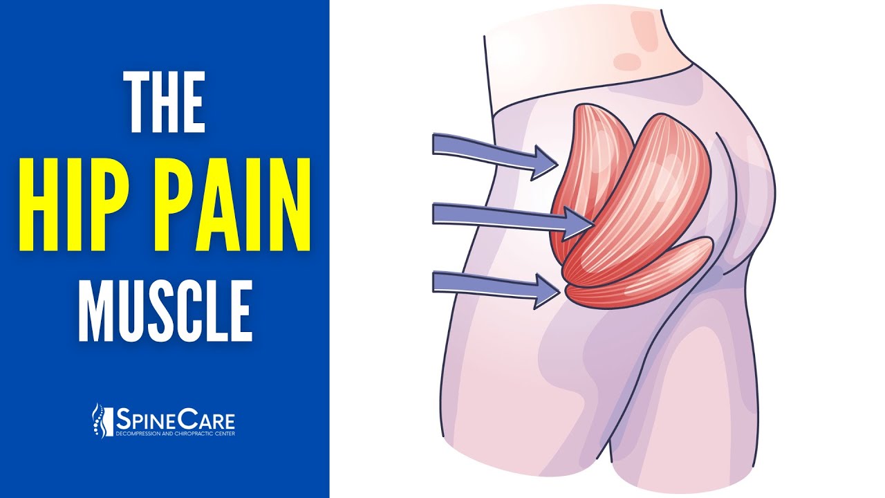 The Hip Pain Muscle (How to Release It for INSTANT RELIEF)