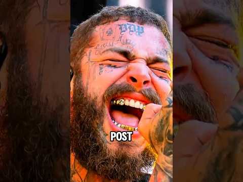 This Rapper Lost His 600k Dollar Tooth 💎🦷