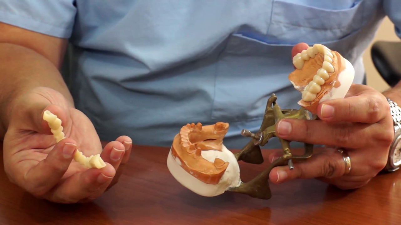 Dental temporaries