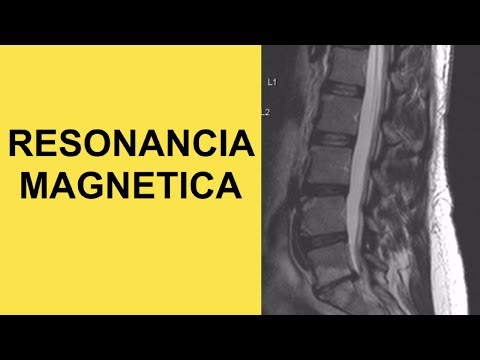 Corsés fractura de la columna cervical Herniación de la columna cervical como dolor