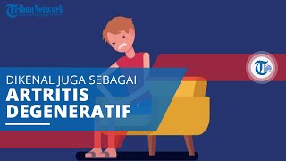 Osteoartritis, Dikenal Juga sebagai Artritis Degeneratif atau Penyakit Degeneratif Sendi